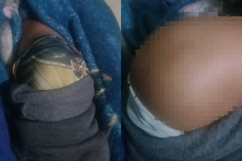 Estudante sofre queda em sala de aula e é atendido após lesão no joelho